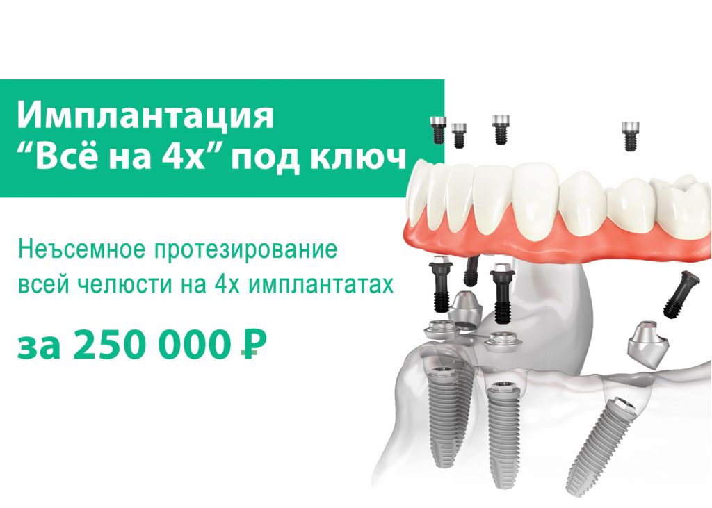 Акция протезирование стоматология Брекеты Томск Белая