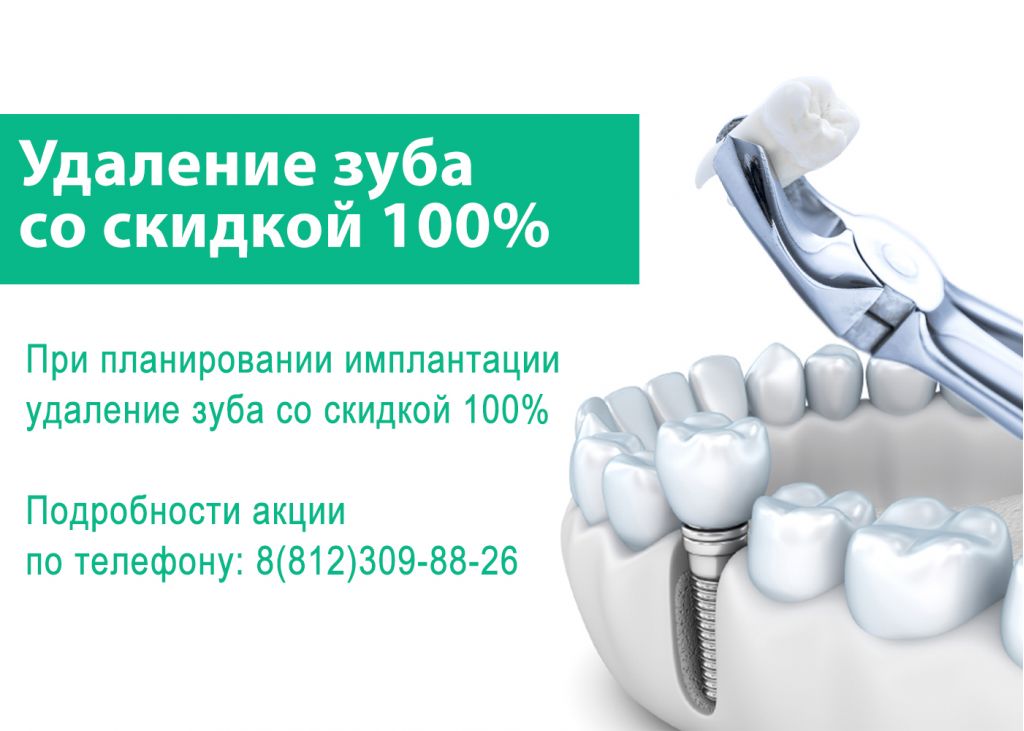 Акция протезирование стоматология Импланты Astra Tech Томск Кубанская